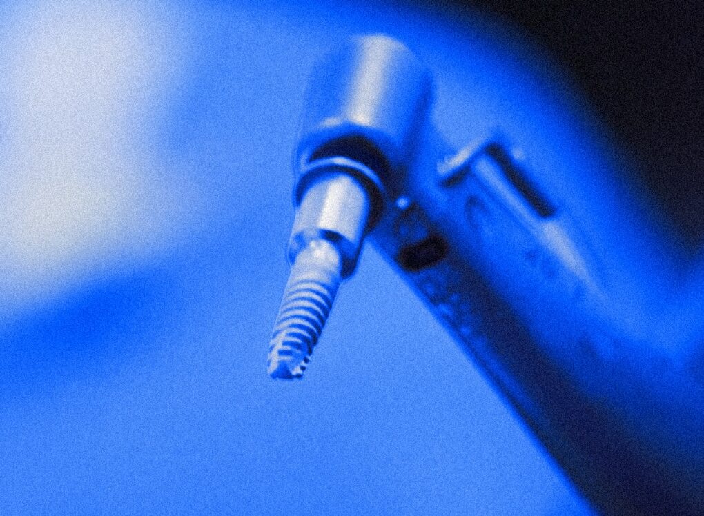 A MIS SEVEN implant on a driver