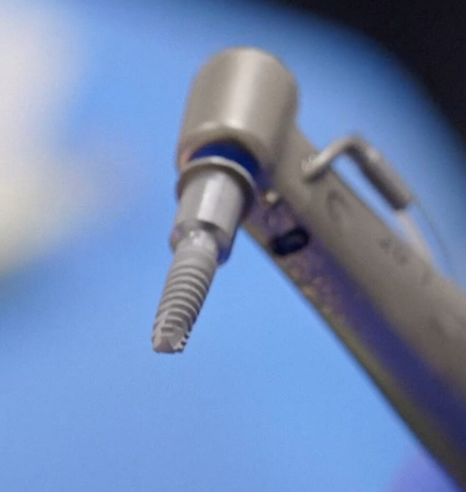MIS implant systems
