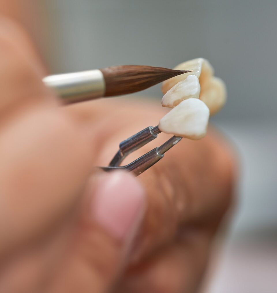 An implant restoration from the MoreDent lab